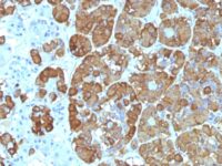 FFPE human pituitary sections stained with 100 ul anti-ACTH (clone CLIP/1449) at 1:300. HIER epitope retrieval prior to staining was performed in 10mM Citrate, pH 6.0.